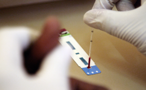 Know how to buy an HIV test kit online