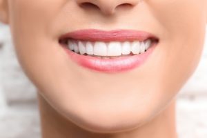 Dental Bonding: What You Should Know Before the Treatment